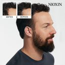 Nioxin-Anti-Hair-Loss-Shampoo-240mL-4064666898575
